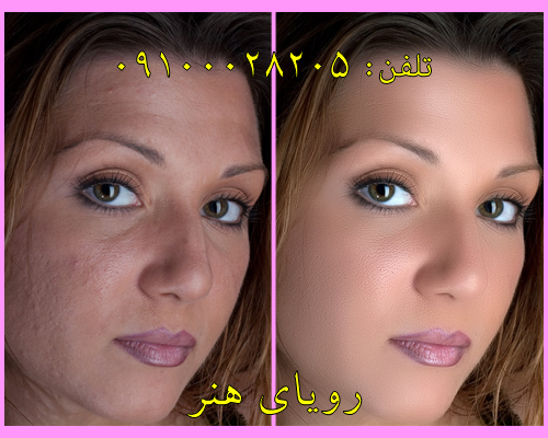 نرم افزار روتوش حرفه ای پوست رویای هنر